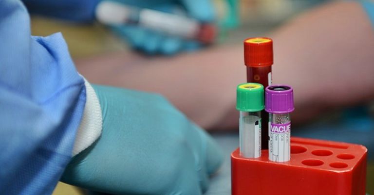 Domestic Workers Are Required to Undergo Medical Screening upon Return to Work in Kuwait